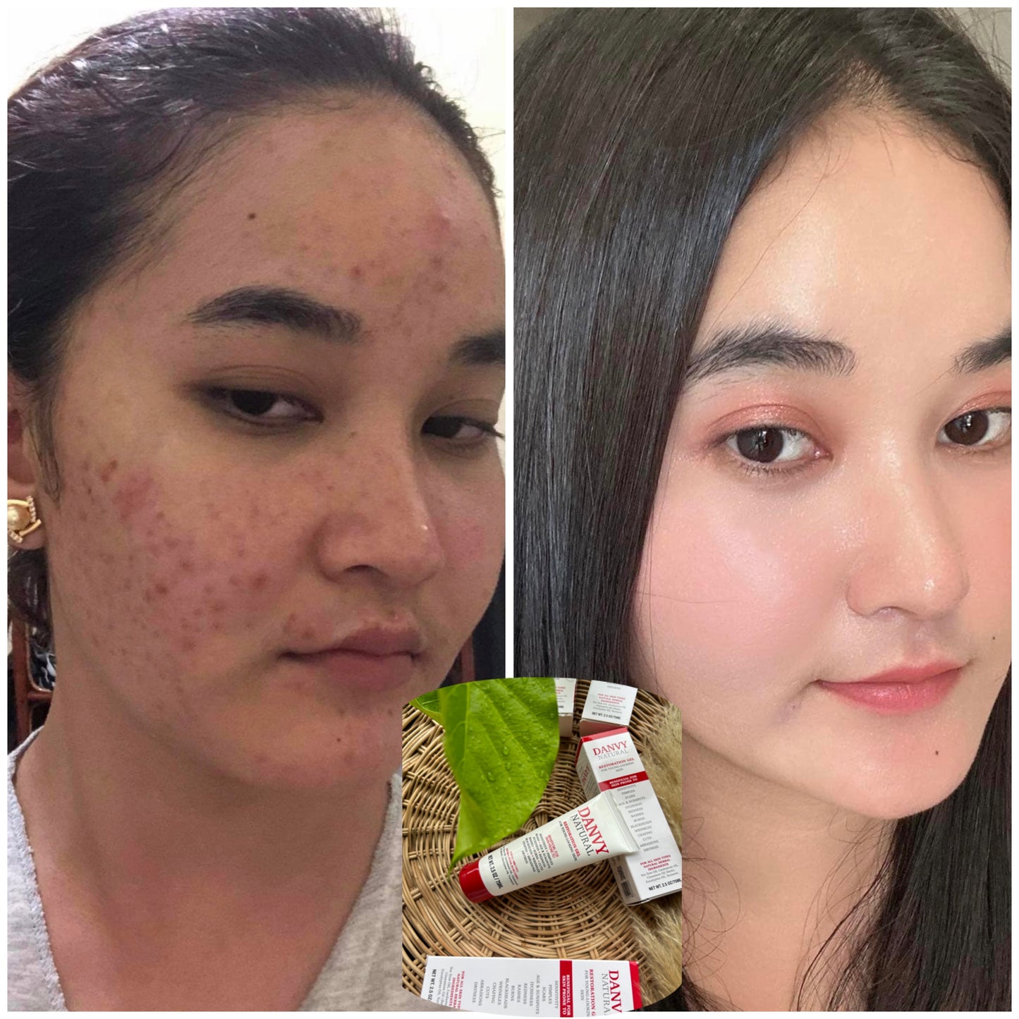 Danvy Natural Restoration Gel